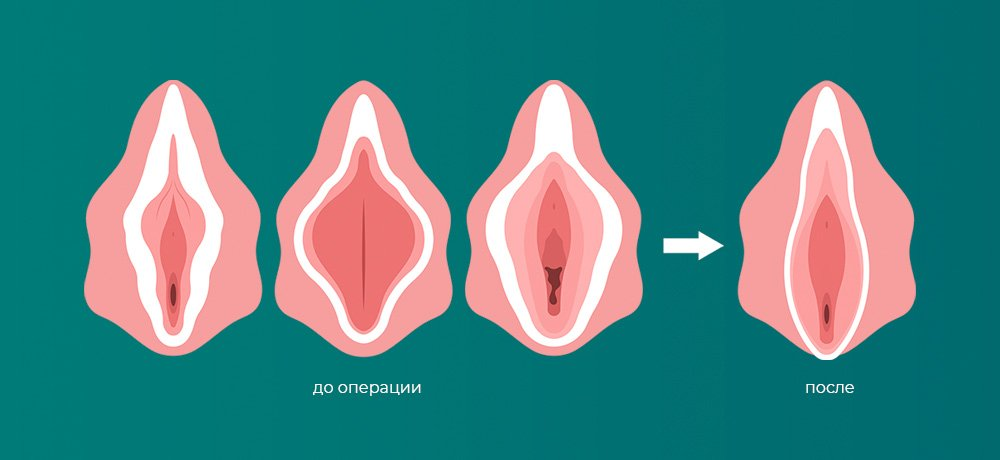 Причины изменений и кто обращается за операцией